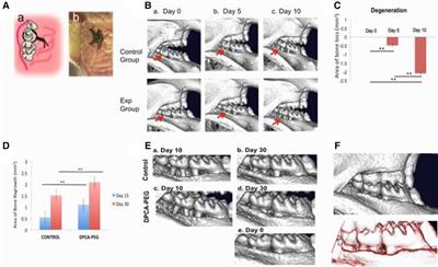 Prolyl-hydroxylase inhibitor-induced regeneration of alveolar bone and soft tissue in a mouse model of periodontitis through metabolic reprogramming